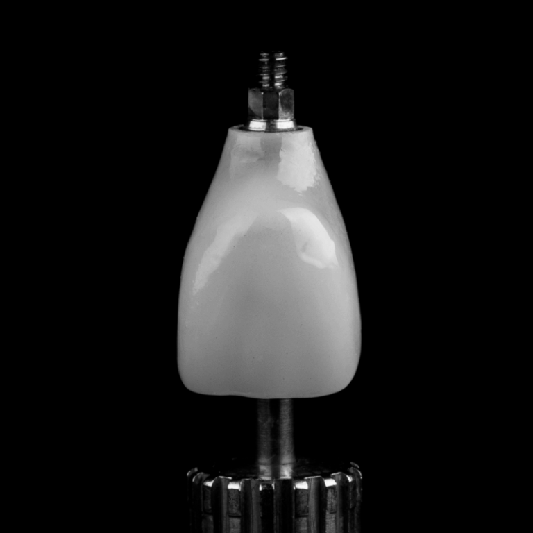 Implanty czy proteza? Co wybrać dla siebie?